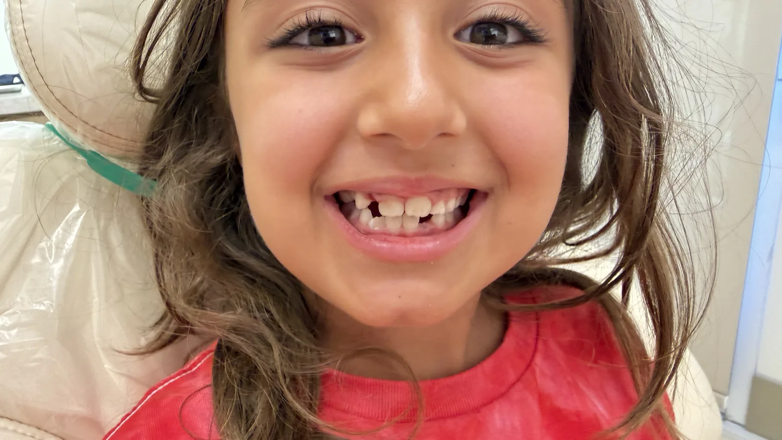 After — Pediatric Dentistry at 2C Wellness Dentistry