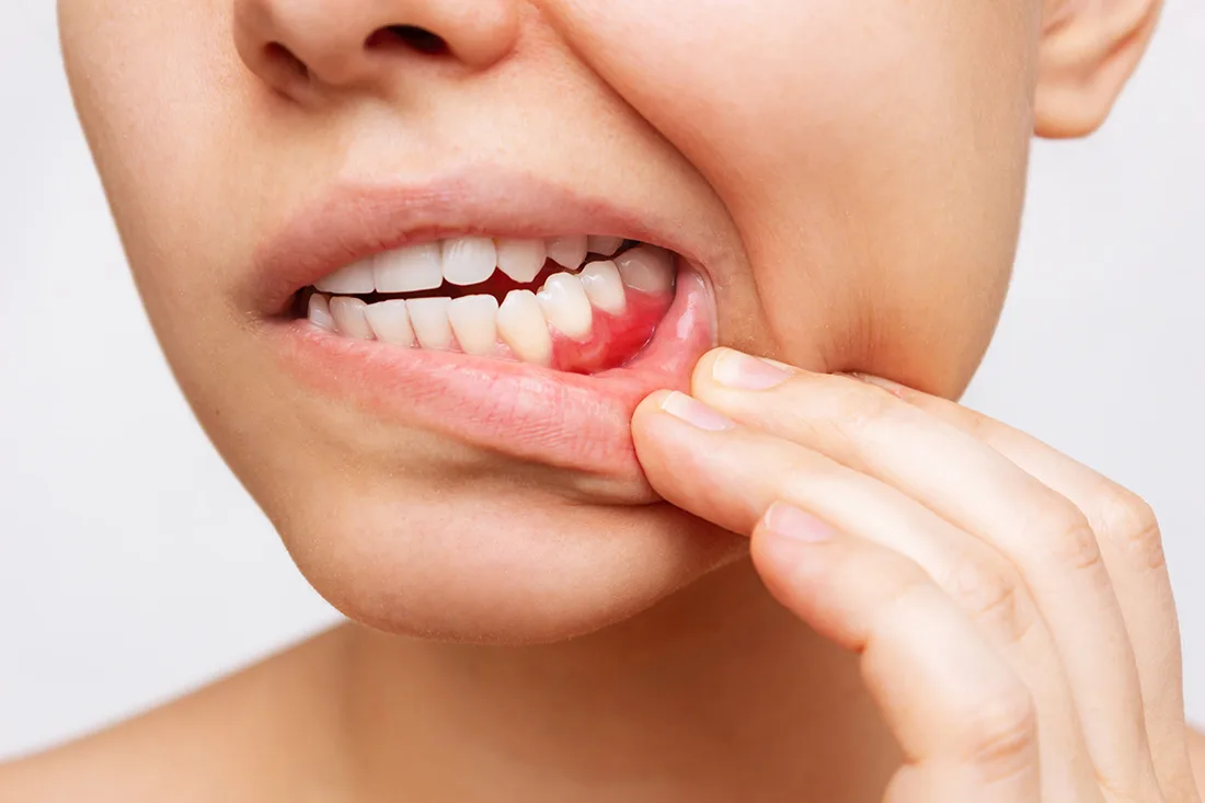 Periodontal Care