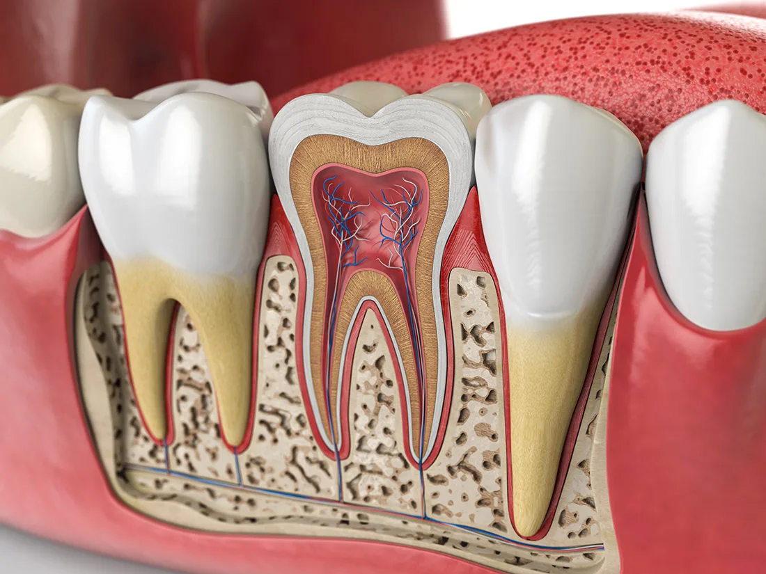 Root Canal Therapy